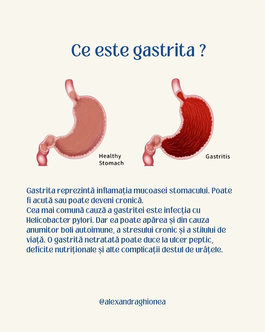 Ce este gastrita ?