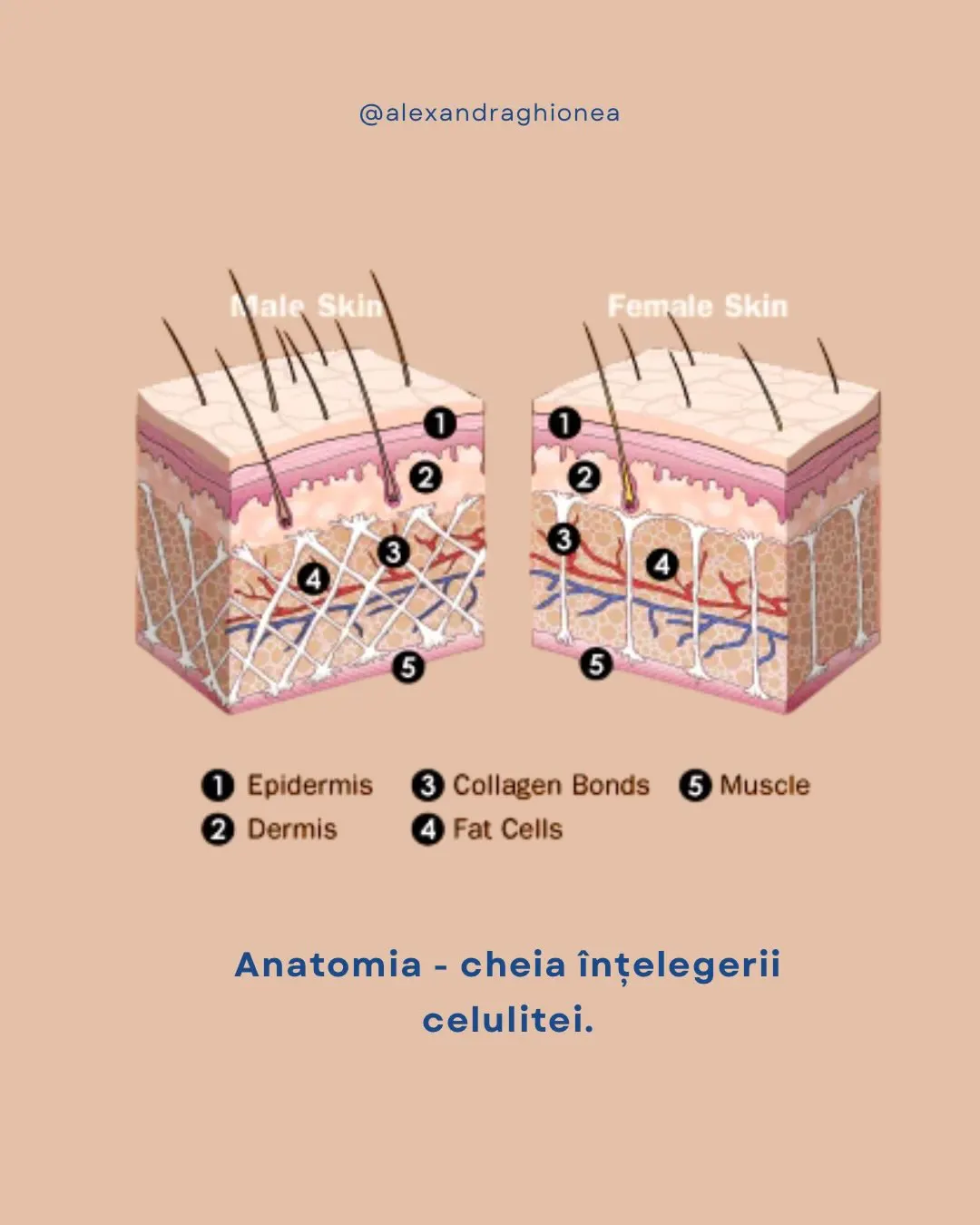 Female Skin