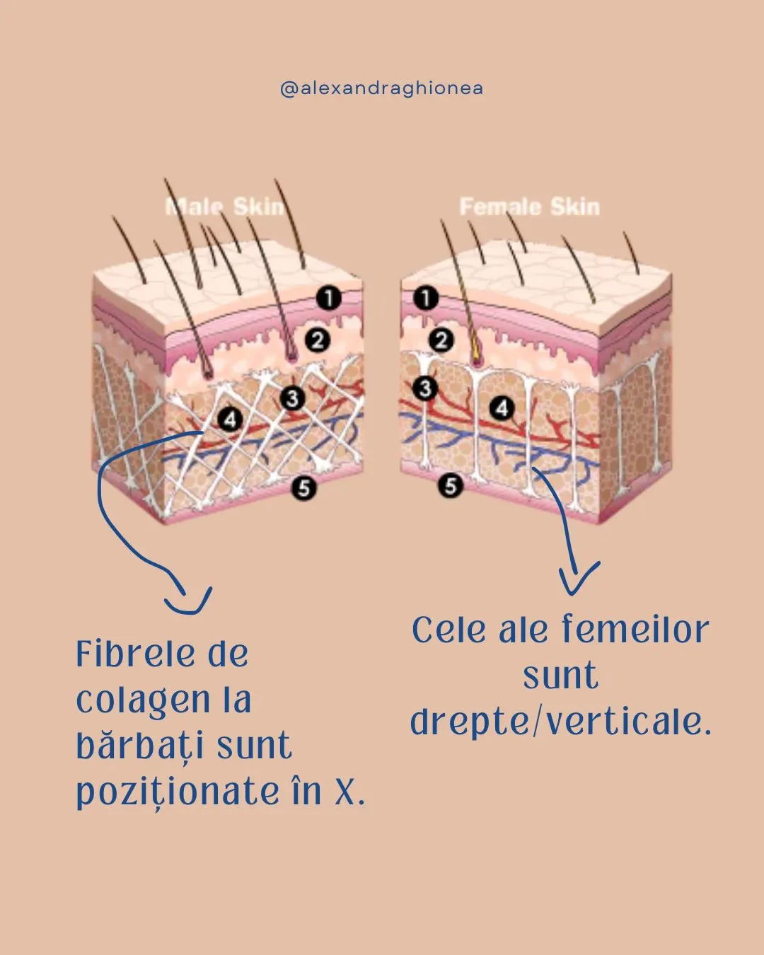 Female Skin
